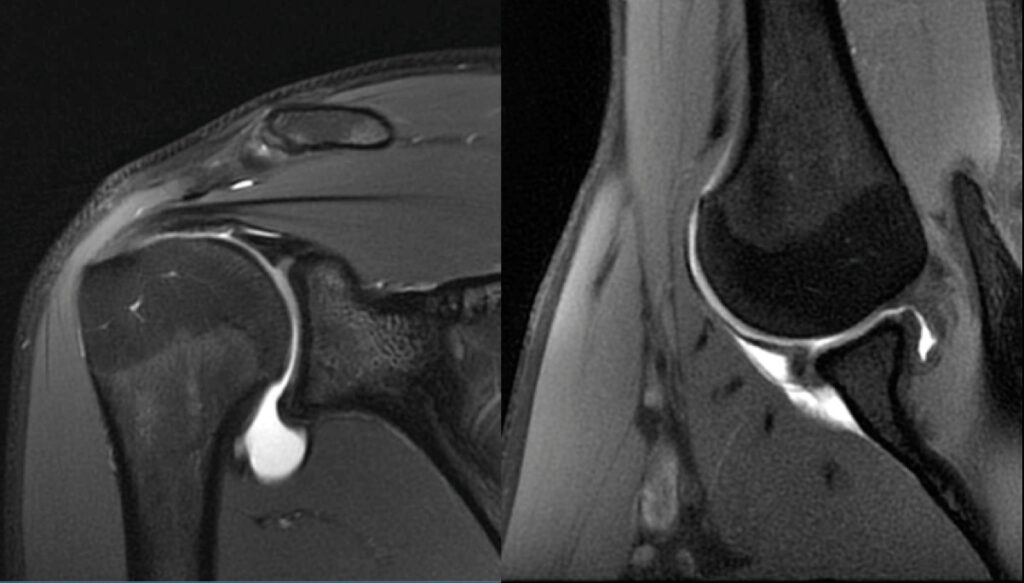 Immagini di risonanza magnetica articolare