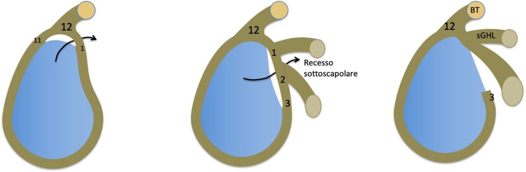 Come Diagnosticare l’Instabilità di Spalla: Lesioni e Imaging con Artro-RM 3 varianti anatomiche labbro glenoideo